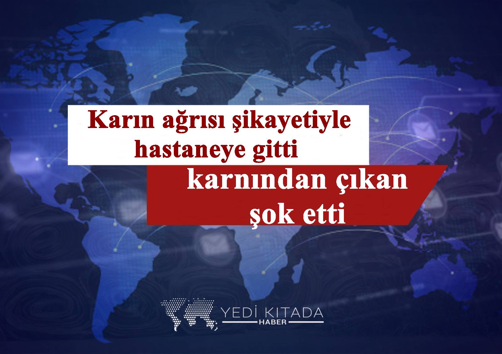 Karin-agrisi-sikayetiyle-hastaneye-gitti-karnindan-cikan-sok-etti