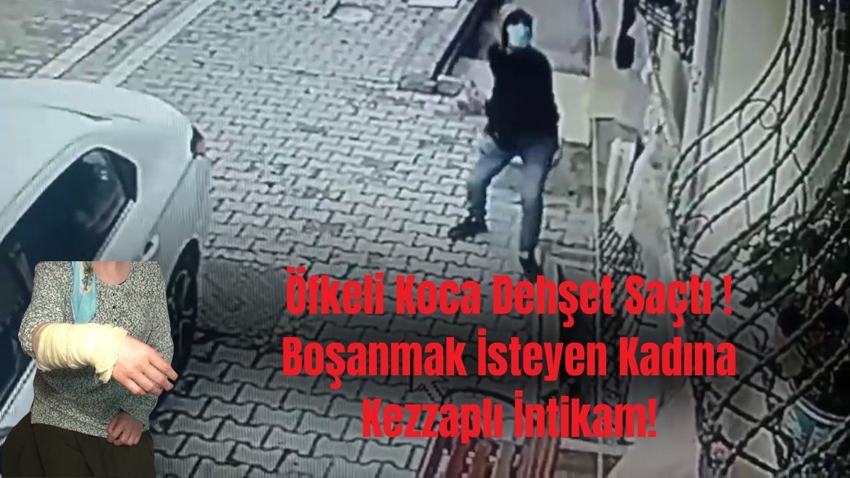 Öfkeli Koca Dehşet Saçtı ! Boşanmak İsteyen Kadına Kezzaplı İntikam!