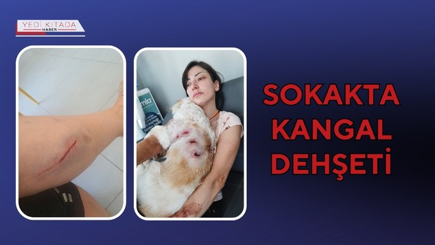 Sokakta Kangal Dehşeti