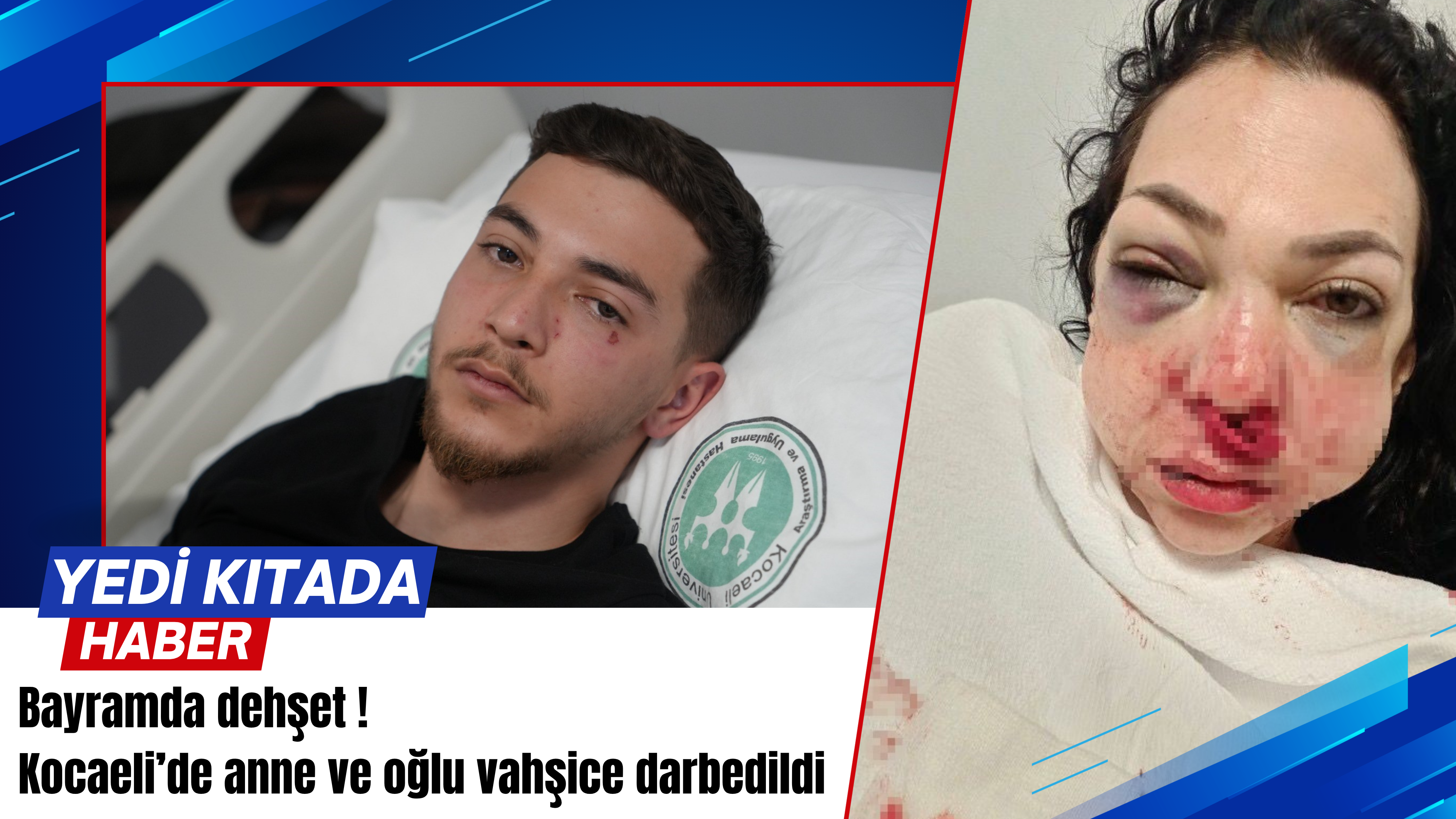 Bayramda dehşet Kocaeli’de anne ve oğlu vahşice darbedildi