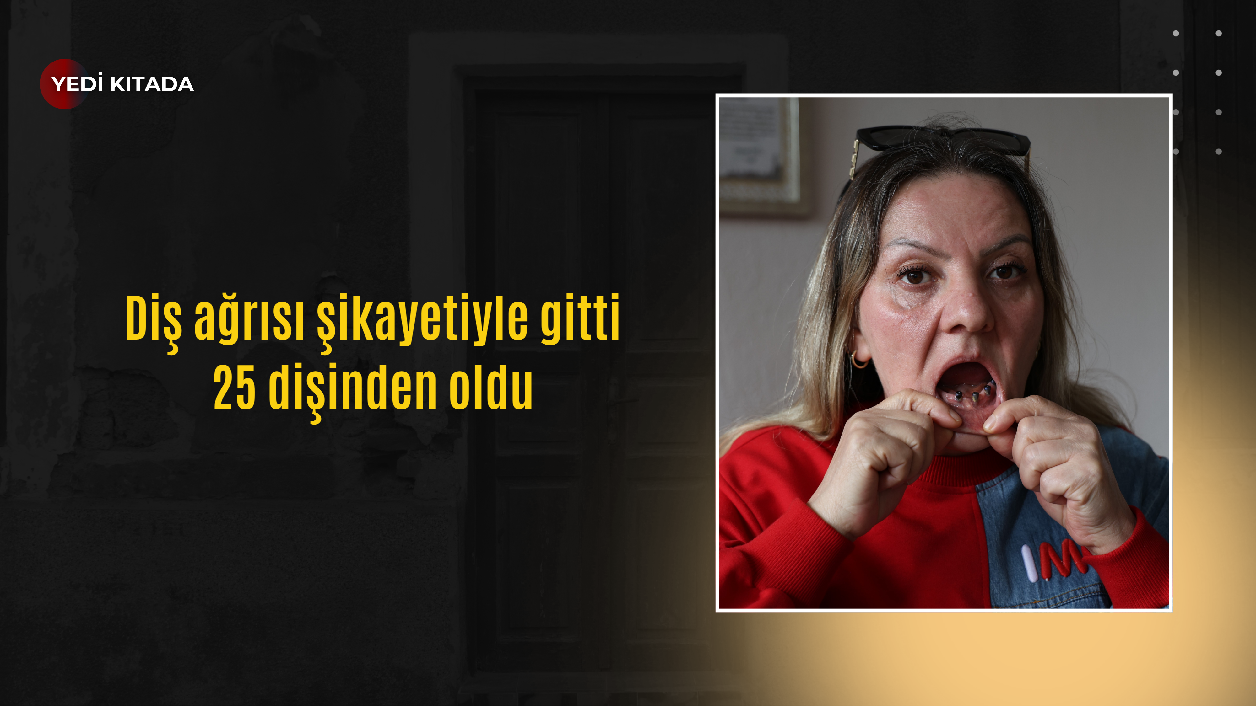 Diş ağrısı şikayetiyle gitti 25 dişinden oldu