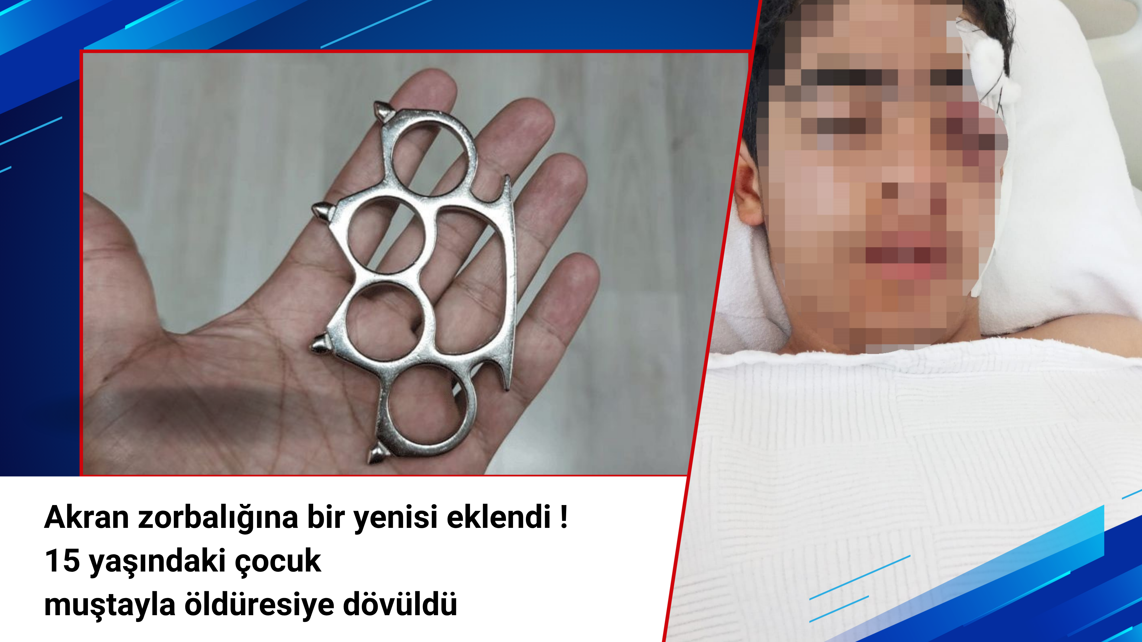 Akran zorbalığına bir yenisi eklendi: 15 yaşındaki çocuk muştayla öldüresiye dövüldü