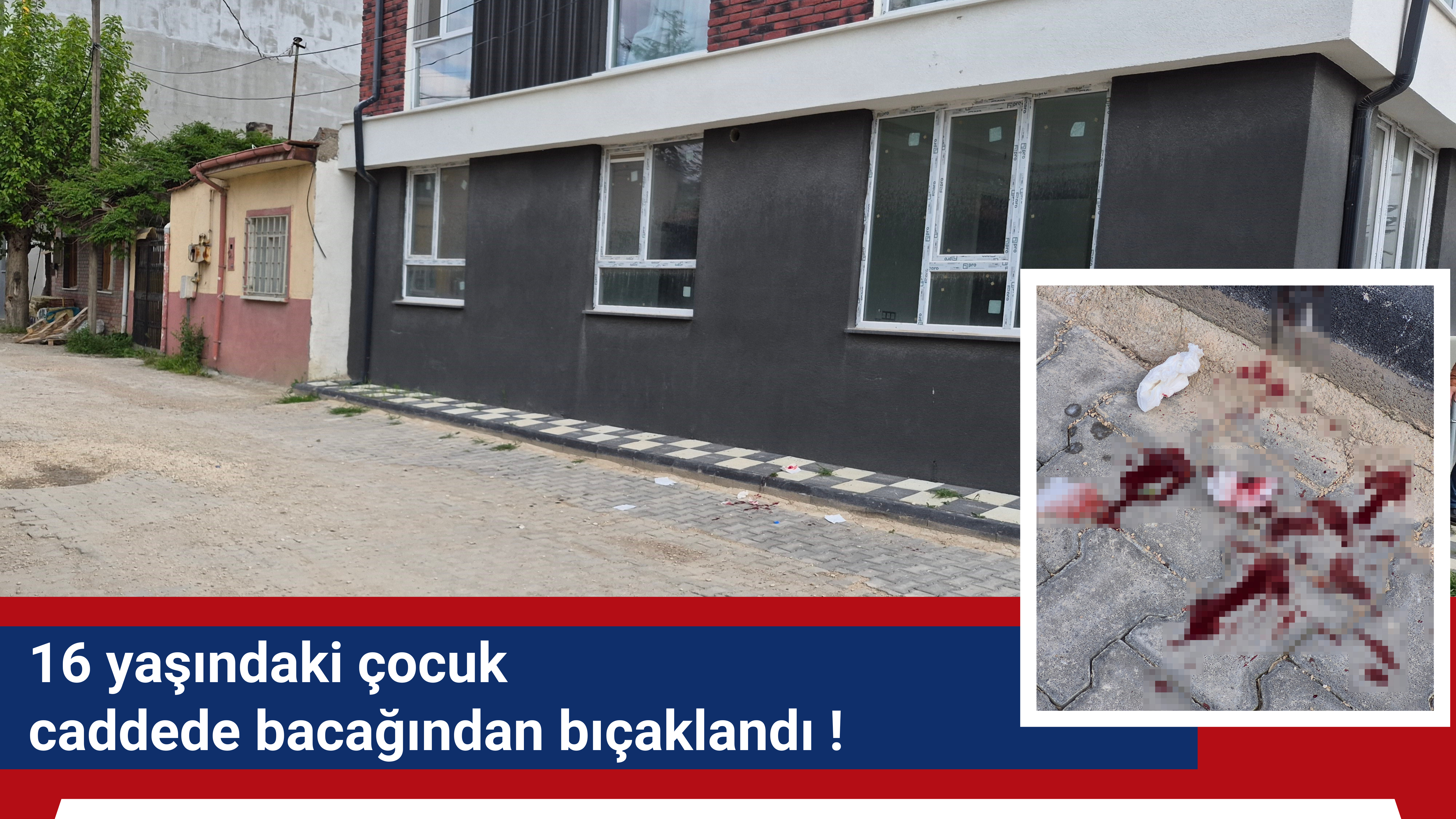 Eskişehir’de 16 Yaşındaki Çocuğa Cadde Ortasında Bıçaklı Saldırı