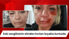 Sarı ve Siyah Dikkat Çekici YouTube Küçük Resmi