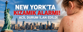 New York’ta Kızamık Alarmı